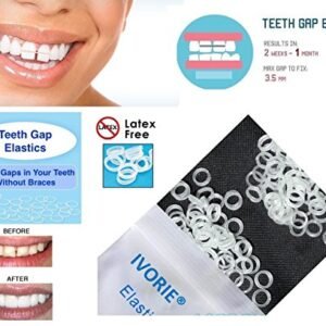 IVORIE Dental Teeth Gap Orthodontic Bands Clear Elastic 100/Pk (3/8" Medium)